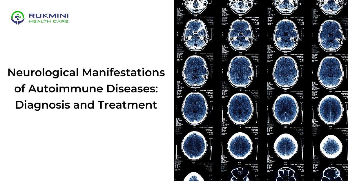 Neurological Manifestations of Autoimmune Diseases Diagnosis and Treatment